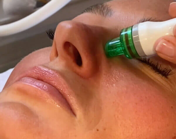 8in1 facial