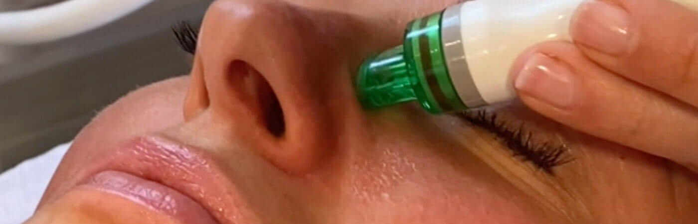 8in1 facial