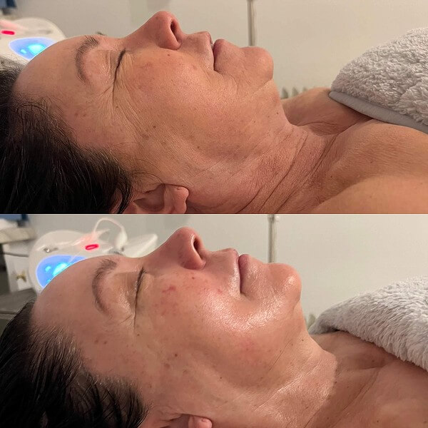 Skin Sculpt